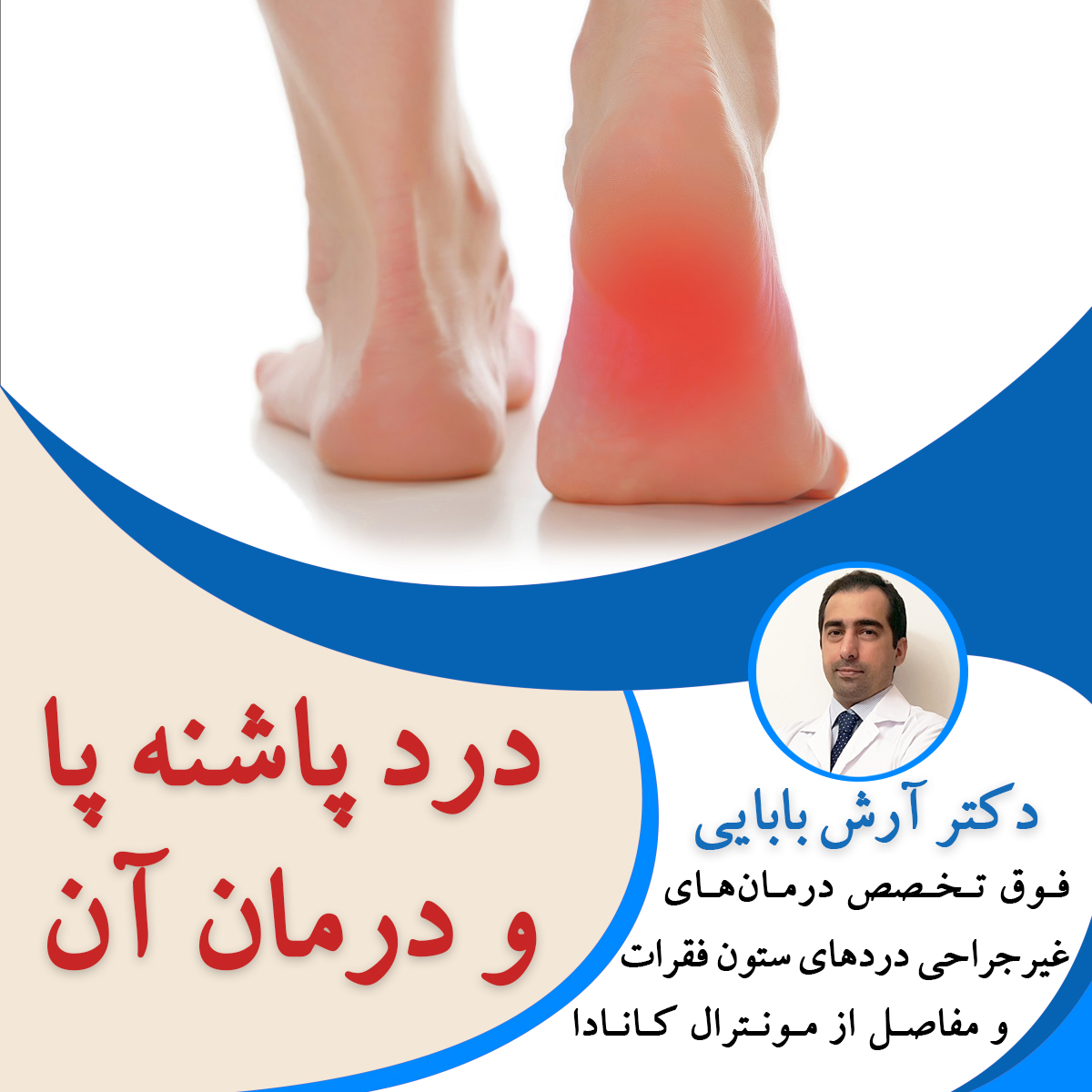 درد پاشنه پا و درمان آن