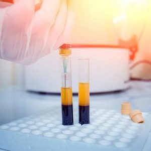 مداخلات تزریقی پیشرفته
