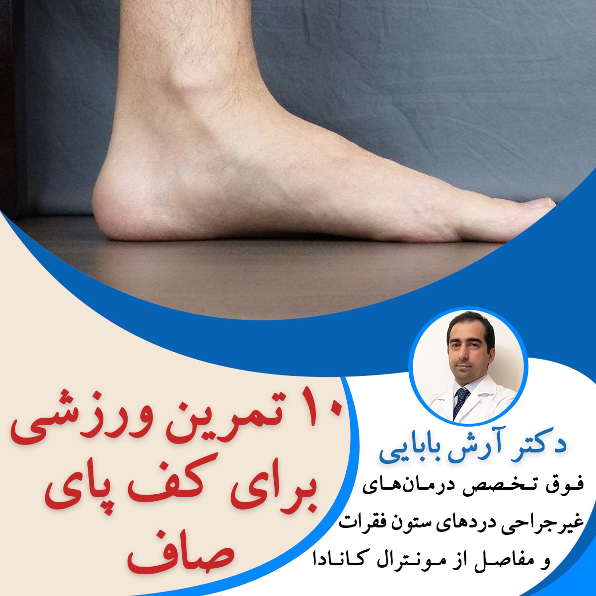 10 تمرین ورزشی برای کف پای صاف
