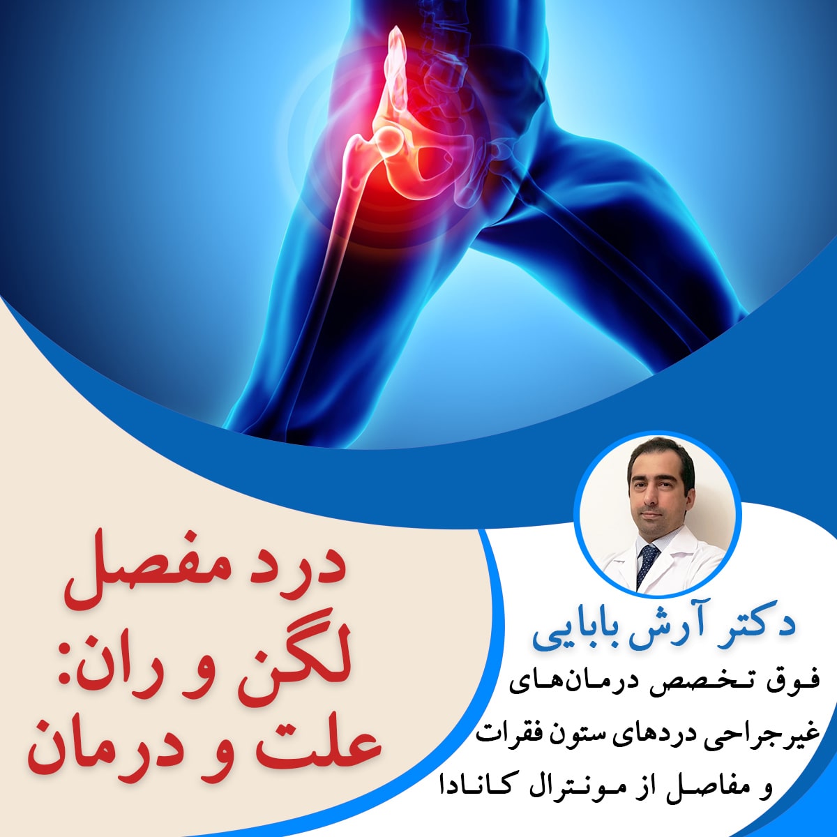 درد مفصل لگن و ران: علت و درمان