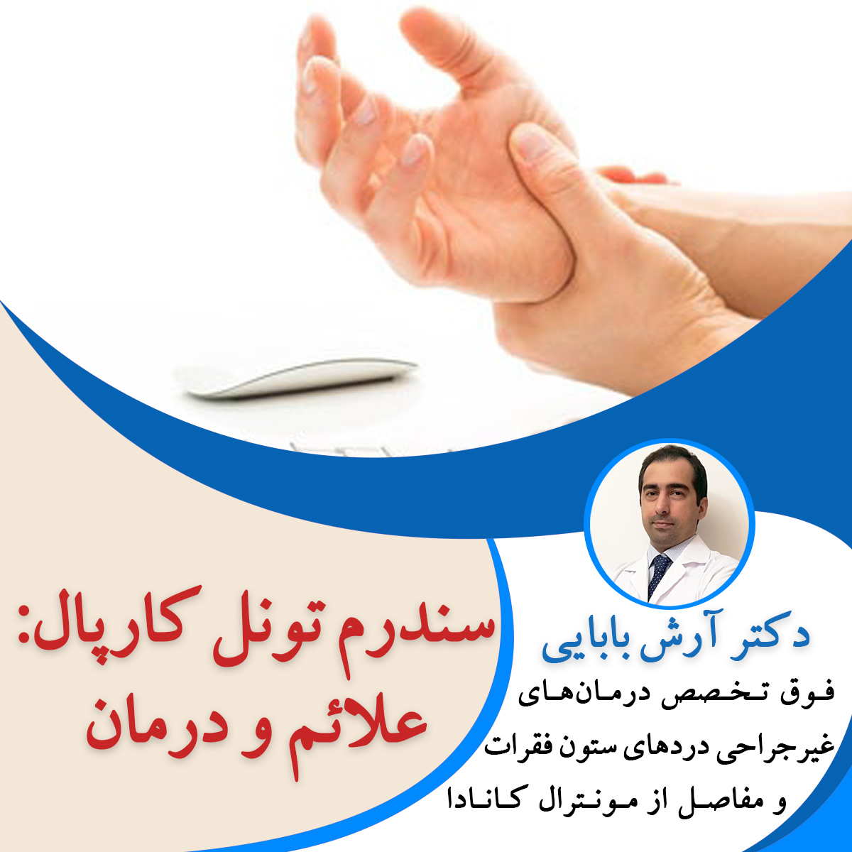 سندرم تونل کارپال
