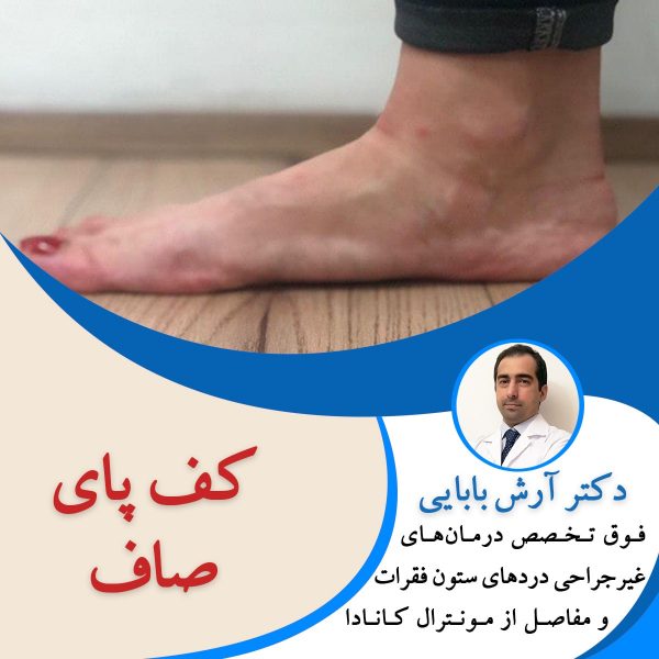 کف پای صاف