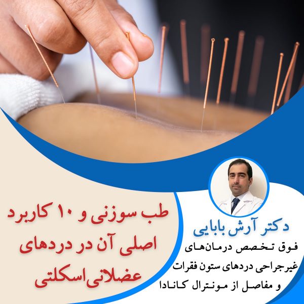 طب سوزنی و 10 کاربرد اصلی آن در دردهای عضلانی اسکلتی
