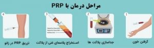 نحوه تهیه و آماده سازی پی آر پی