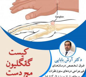 کیست گانگلیون مچ دست