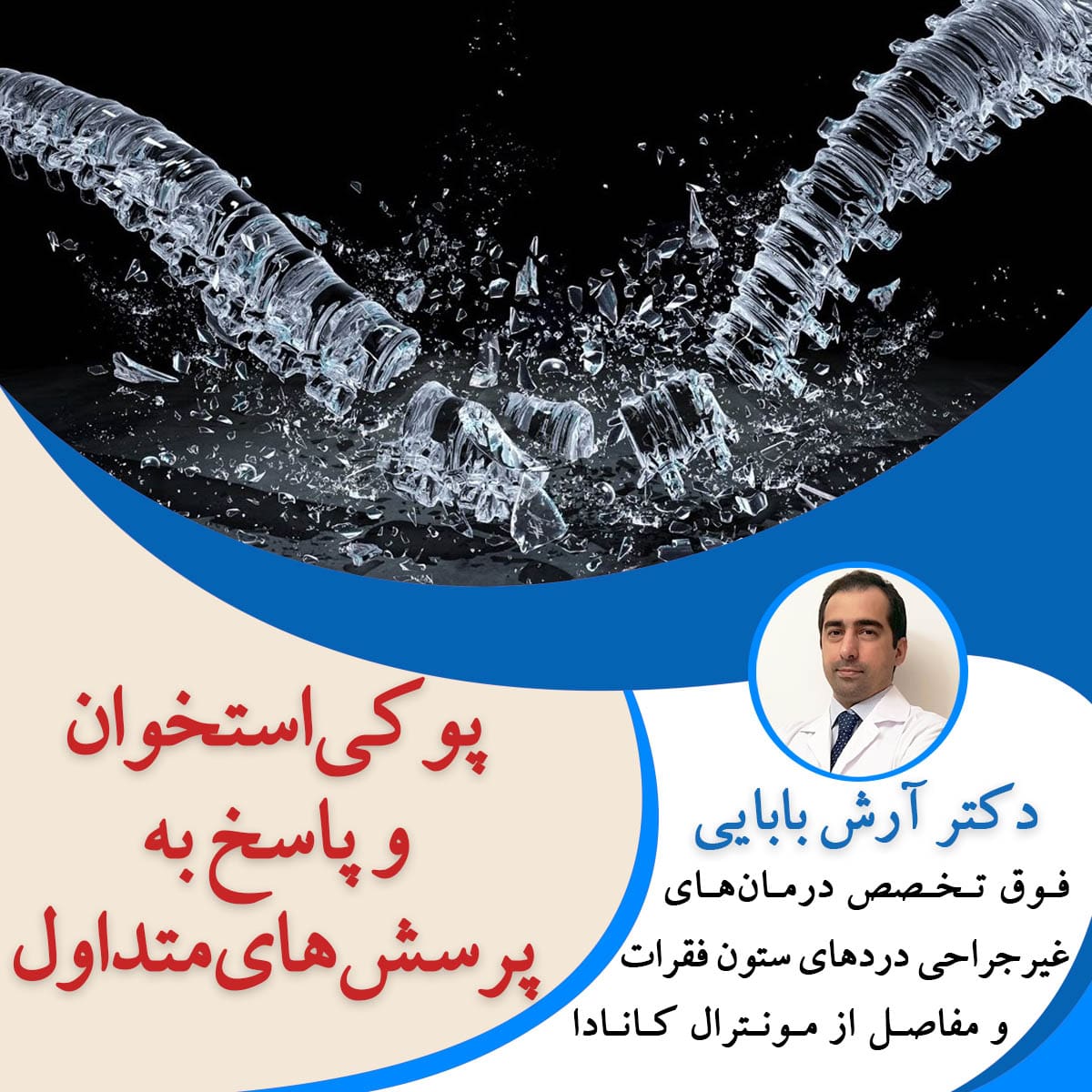 پوکی استخوان و پاسخ به پرسش های متداول