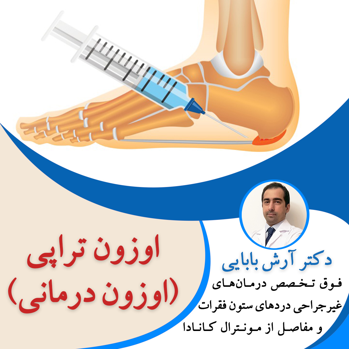 اوزون تراپی (اوزون درمانی)