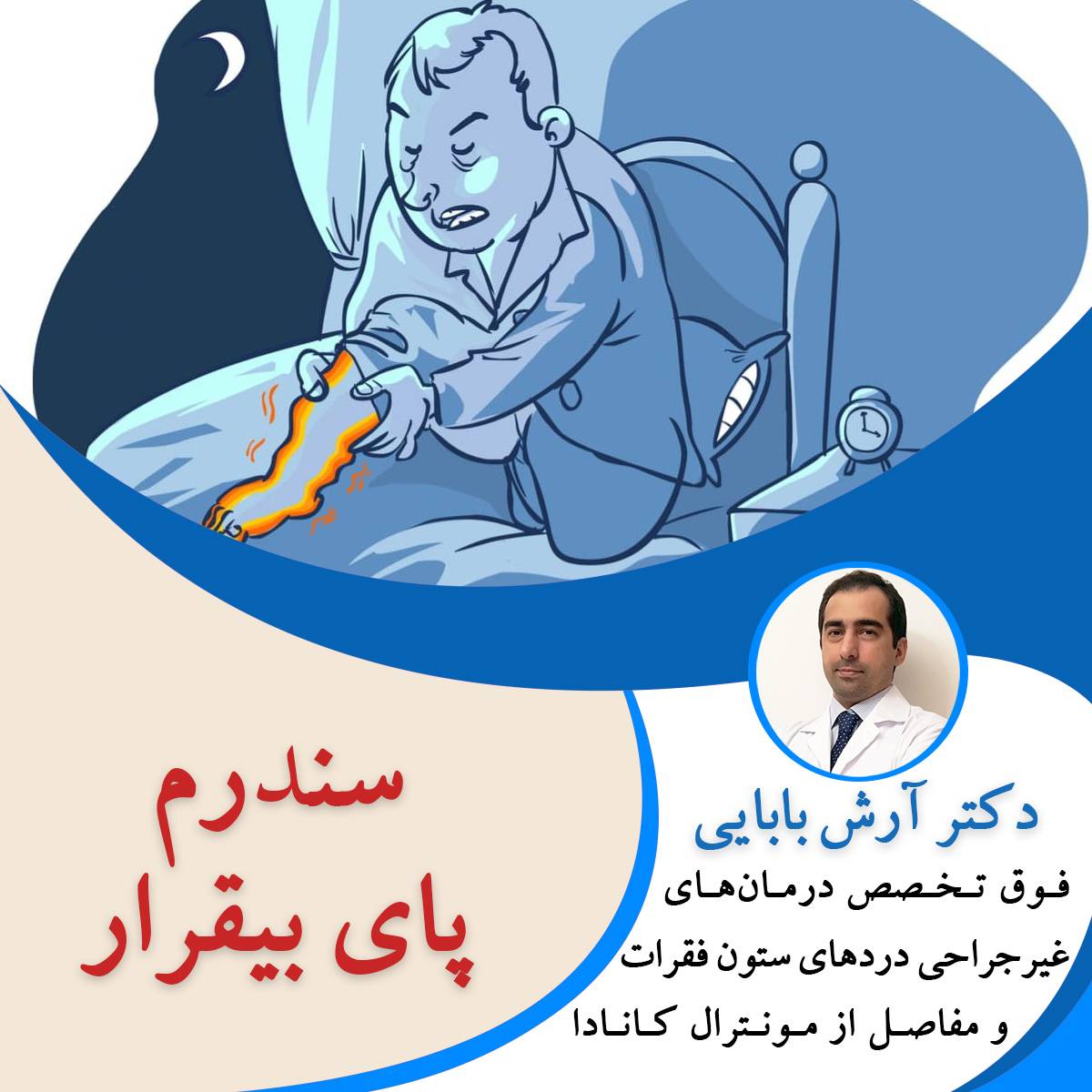 سندرم پای بی قرار