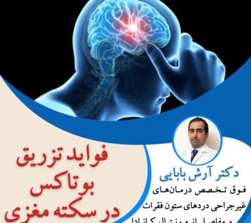 فواید تزریق بوتاکس در سکته مغزی