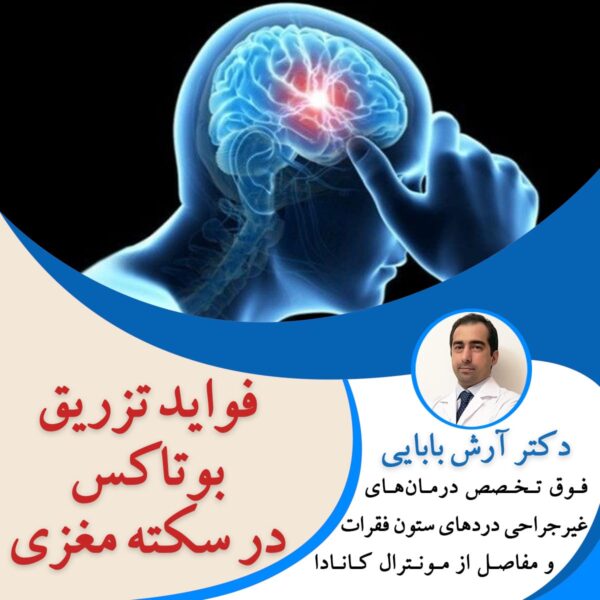 فواید تزریق بوتاکس در سکته مغزی