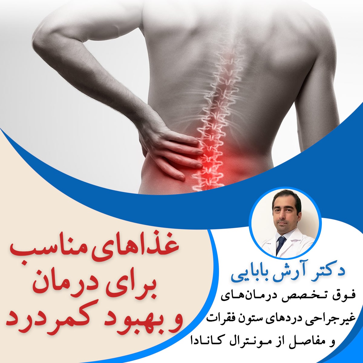 غذاهای مناسب برای درمان و بهبود کمردرد