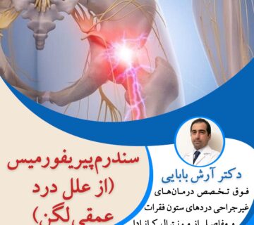 سندرم پیریفورمیس