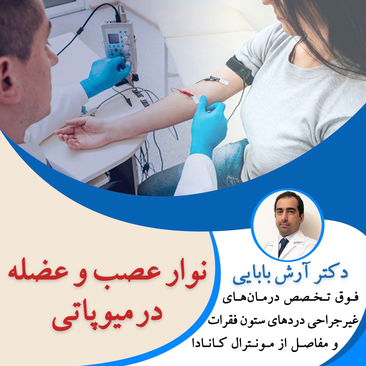 نوار عصب و عضله در میوپاتی 