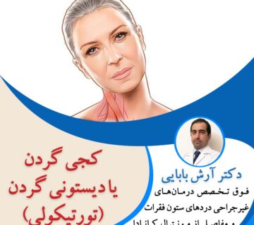 کجی گردن یا دیستونی گردن (تورتیکولی)