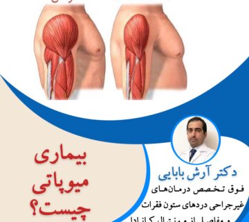 بیماری میوپاتی چیست؟