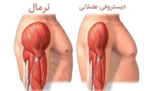 دلایل میوپاتی