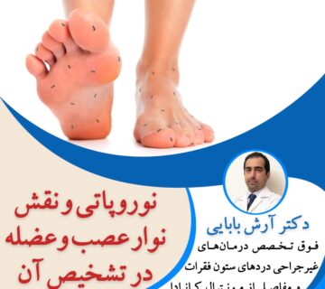 نوروپاتی و نقش نوار عصب و عضله در تشخیص آن