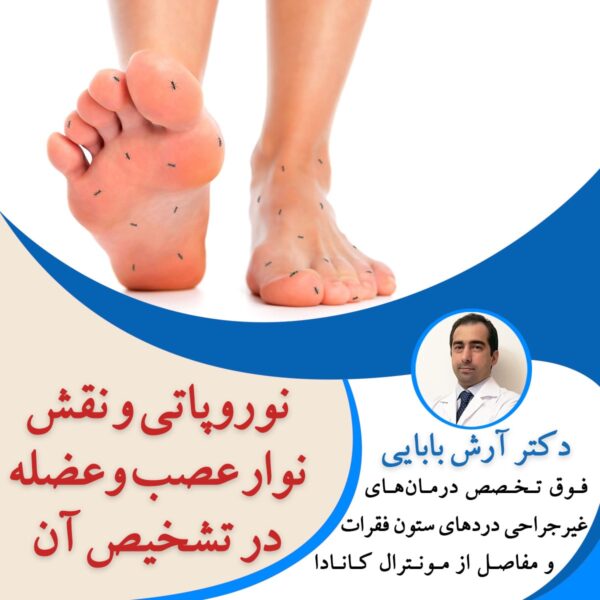 نوروپاتی و نقش نوار عصب و عضله در تشخیص آن
