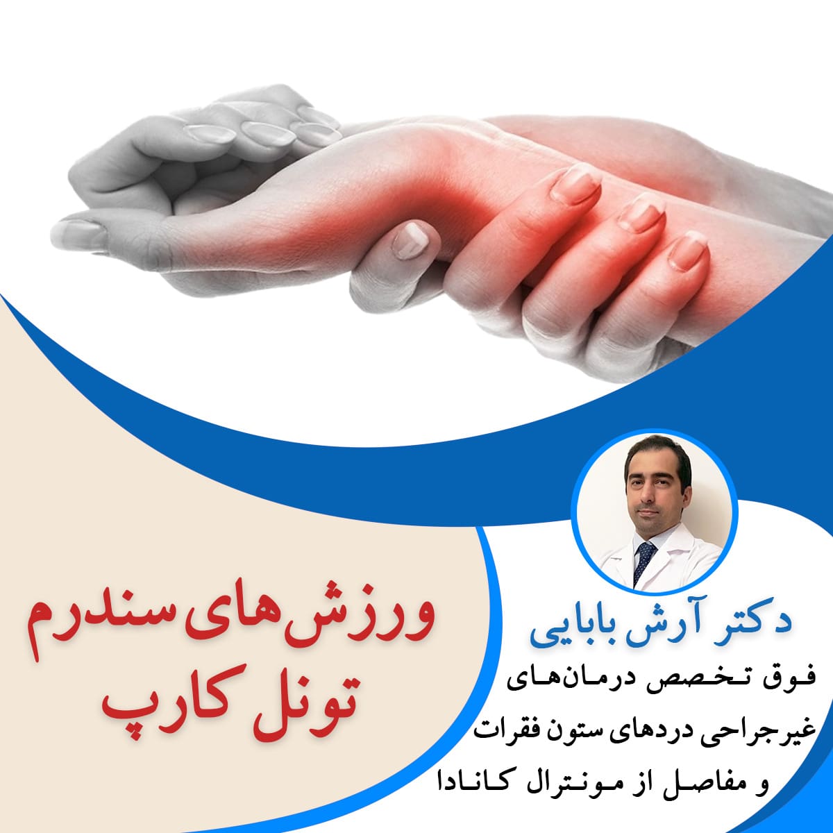 ورزش های سندرم تونل کارپ