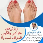 ورزش‌های هالوکس والگوس (انحراف شست پا)