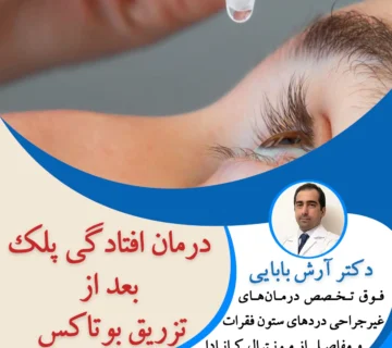 درمان افتادگی پلک بعد از تزریق بوتاکس