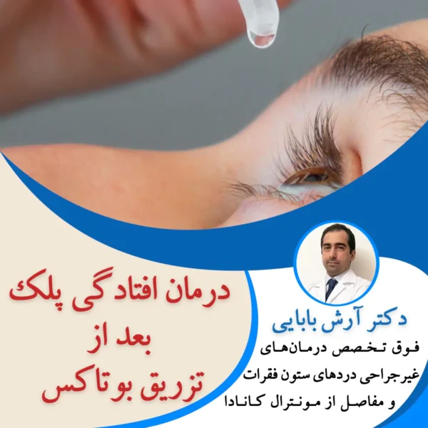 درمان افتادگی پلک بعد از تزریق بوتاکس