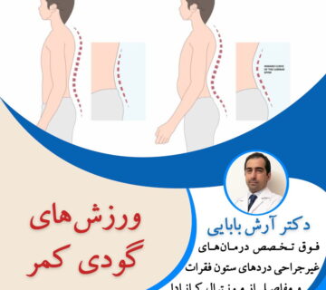 ورزش های گودی کمر